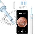 Inskam Find B WiFi Digital Otoscope for Ear Cleaning - White